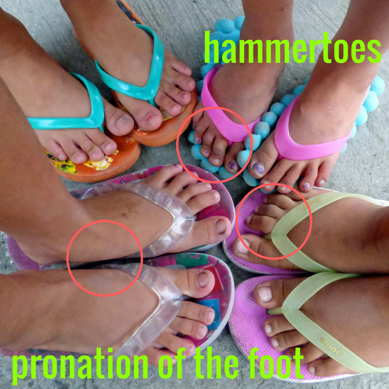 flip flops for pronation